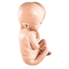 Latex Formaldehyde Skin Siamese Twin Fetus