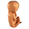 Formaldehyde Skin Siamese Twin Specimen