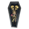 Conjoined Siamese Twin Skeleton in Coffin