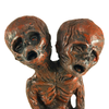 Siamese Twin Mummy Fetus Jar
