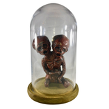 Siamese Twin Mummy Fetus Jar