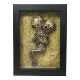 Framed Specimen Siamese Twin Mummy