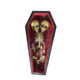 Conjoined Siamese Twin Skeleton in Coffin