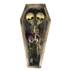 Conjoined Siamese Twin Skeleton in Coffin