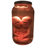 Deluxe Siamese Twin Fetus Specimen