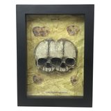 Framed Siamese Twin Triclops Fetus Skull