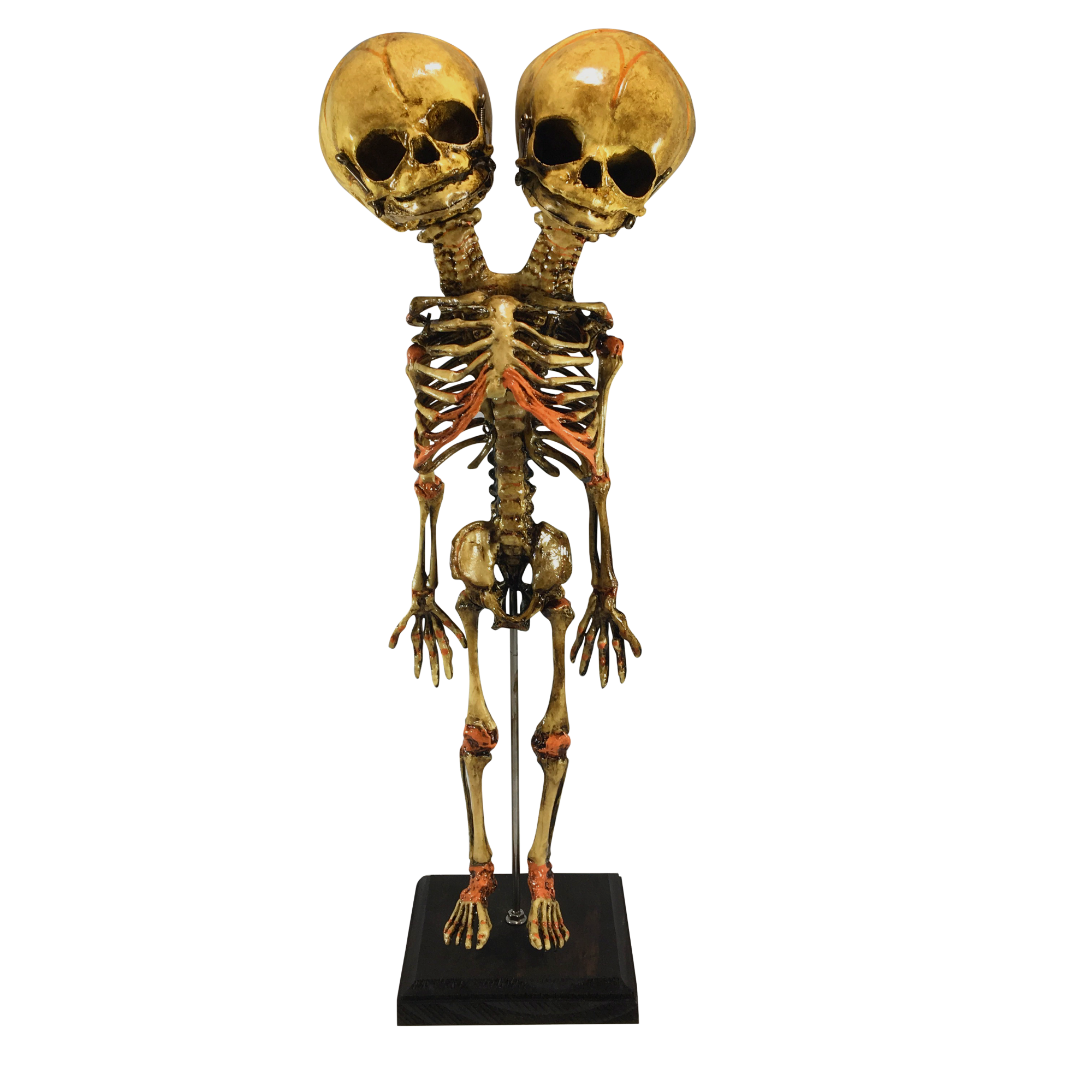 Vintage Deluxe Siamese Twin Skeleton – asylumzone