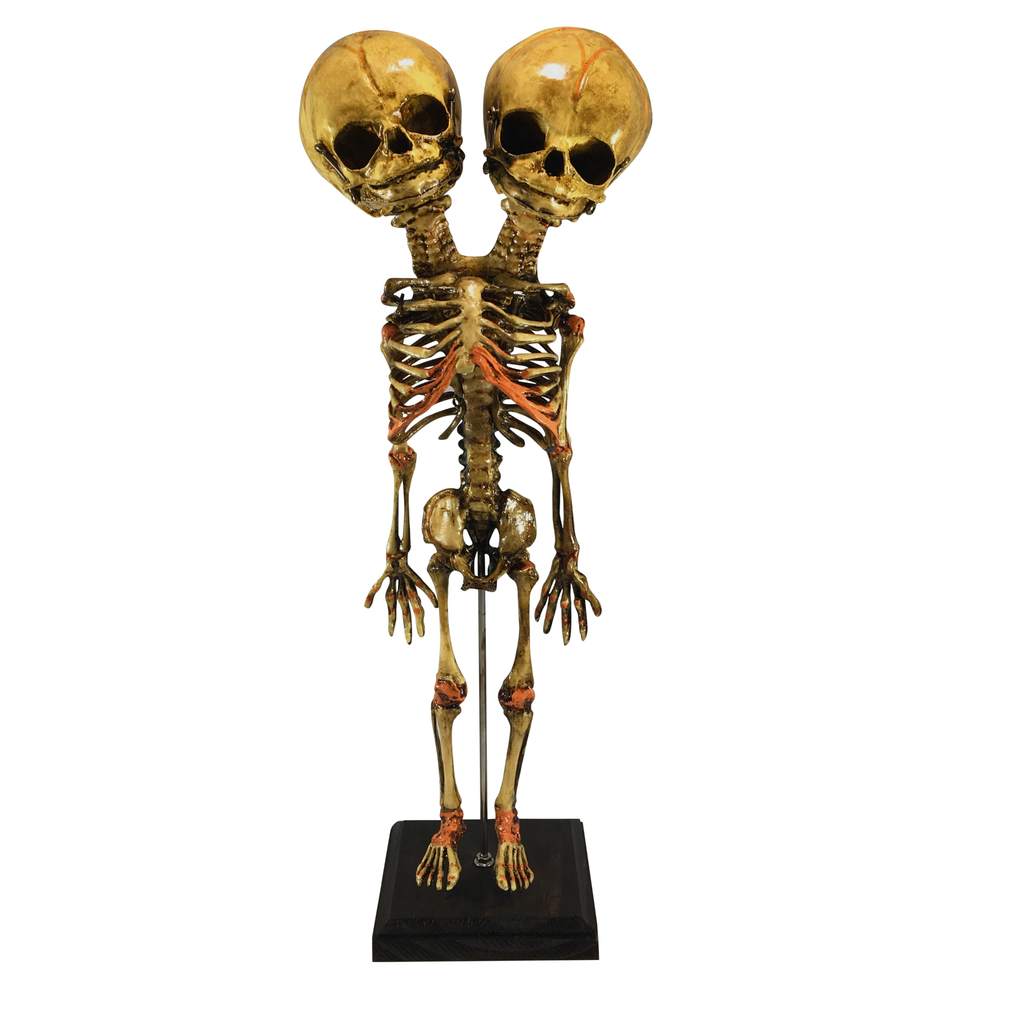 Vintage Deluxe Siamese Twin Skeleton