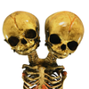 Vintage Deluxe Siamese Twin Skeleton
