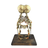 Cephalopagus Siamese Twin Skeleton