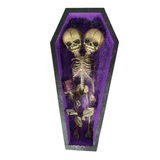 Conjoined Siamese Twin Skeleton in Coffin